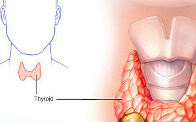 Hạch to - Hình ảnh minh họa